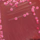 Image for article titled This microbe is making you fat